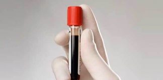 SCIENZA – Sangue da cellule di pelle umana.