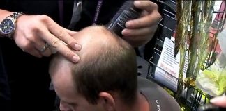 Un prodotto incredibile! Fa apparire i capelli dove non ci sono! [VIDEO]