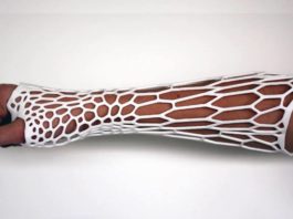 Cortex Cast esoscheletro gesso video