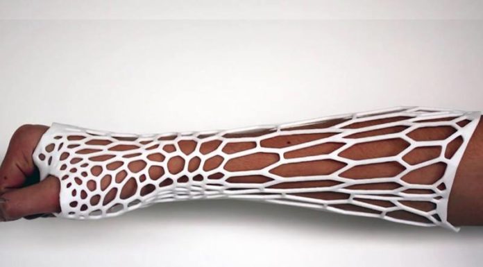 Cortex Cast esoscheletro gesso video